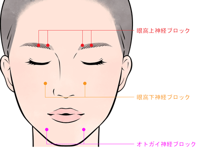顔面の神経ブロックの図