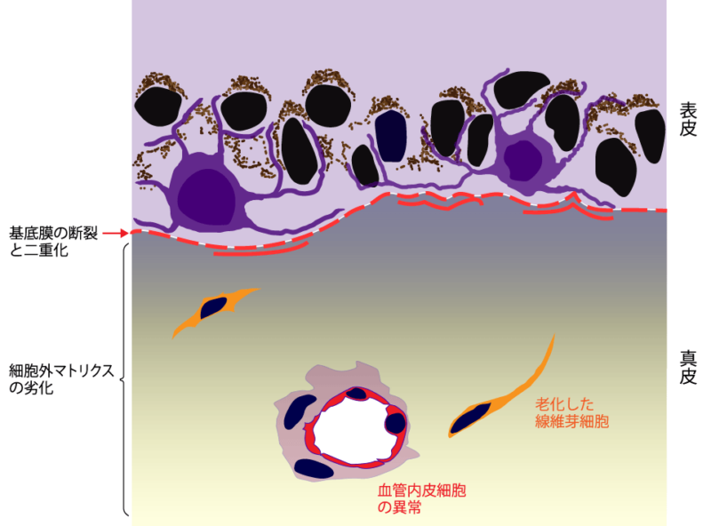 肝斑出現のメカニズム図（線維芽細胞の老化と細胞外マトリクスの劣化）