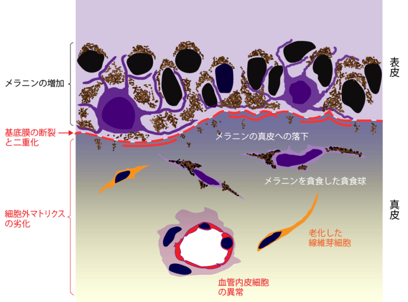 肝斑出現のメカニズム図（肝斑発生の最終段階）