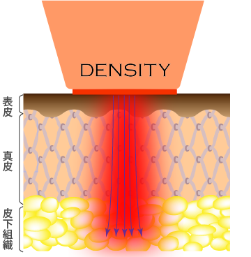 デンシティのモノチップの働き