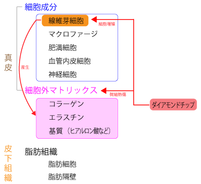 ダイアモンドチップの遅発効果