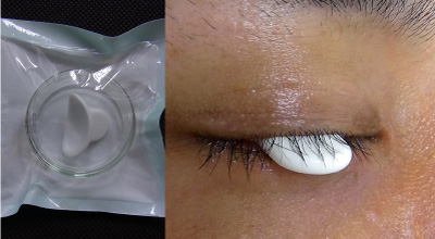 眼球保護コンタクトシェル