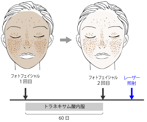 山手皮膚科クリニックでの治療計画