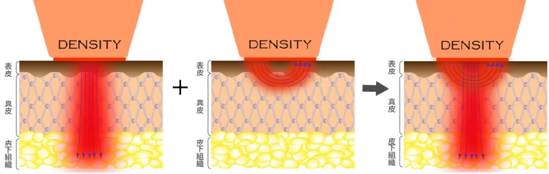 デンシティのモノバイチップの働き