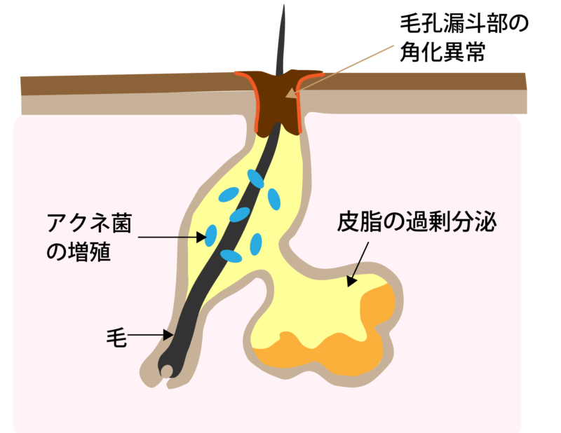 レーザーフェイシャルの作用機序1