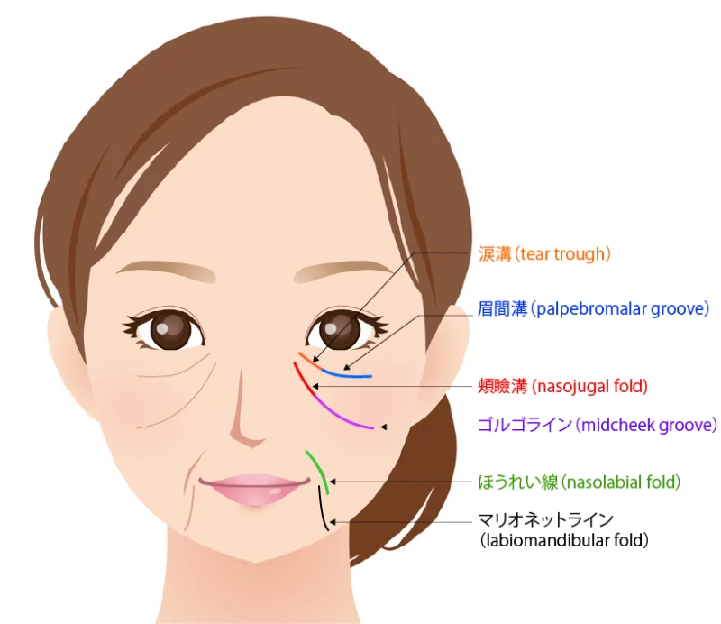 顔のしわの分類