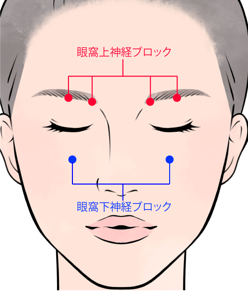 神経ブロックの位置