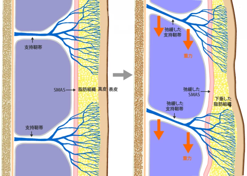 支持靭帯の構造