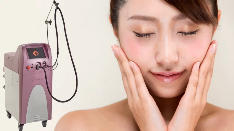 VビームⅡアイキャッチ画像