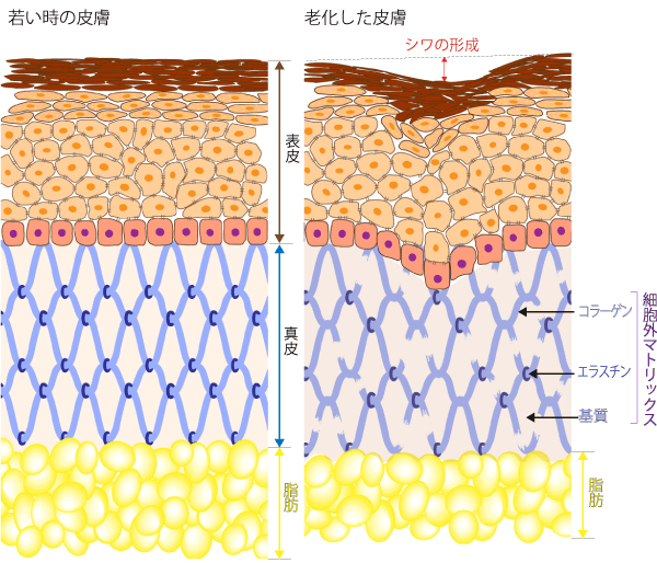 若い時と老化した皮膚の違い