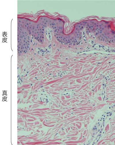 表皮と真皮の組織写真