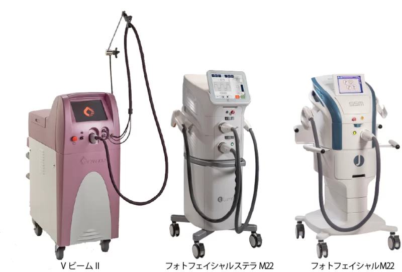 毛細血管拡張（VビームⅡ／Vフェイシャル／フォトフェイシャルM22）