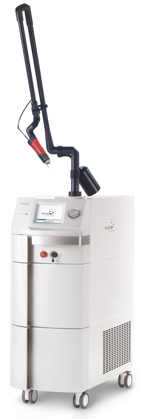 Qスイッチルビーレーザーの写真