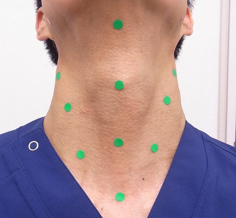 プロファイロの注入点（首）