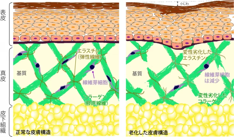 正常と老化して皮膚の構造の違い