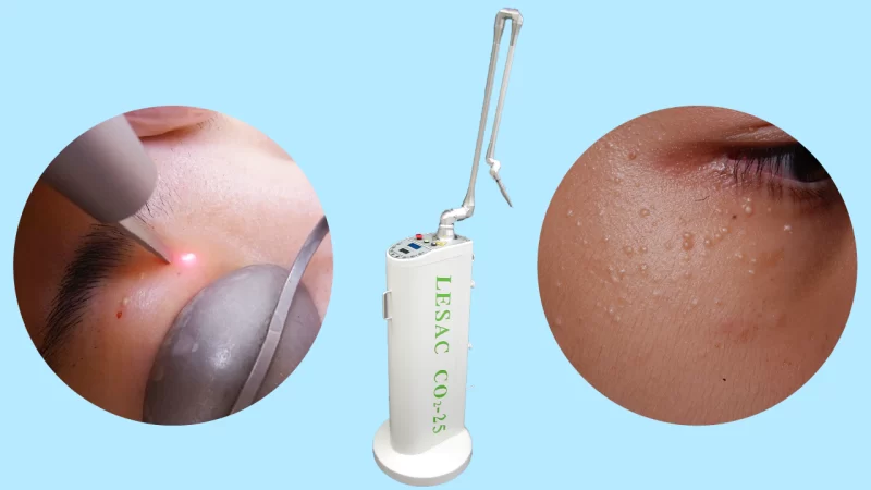 稗粒種アイキャッチ画像