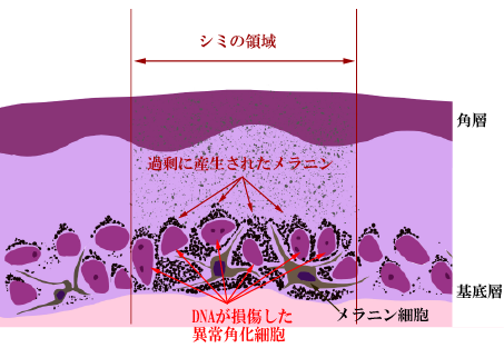 老人性色素斑の病理図