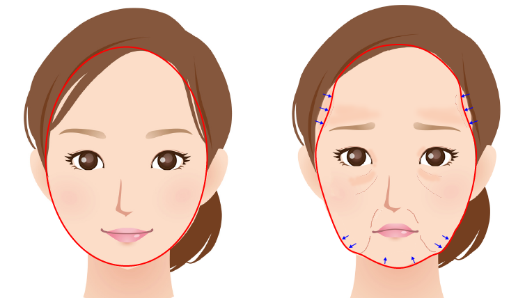 加齢による顔の輪郭の変化
