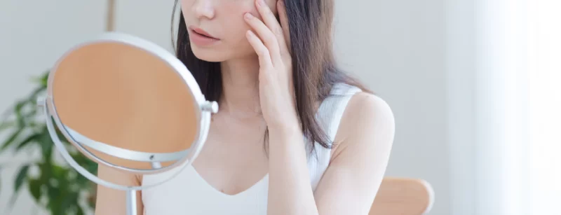 老人性色素斑アイキャッチ画像