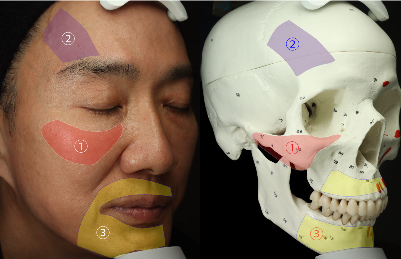 肝斑の好発部位図