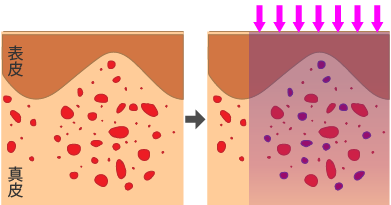レーザーのパルス幅を中間で設定した.場合の図