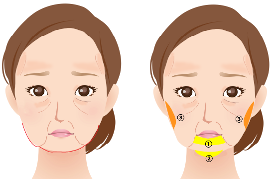 加齢による顔の輪郭の変化