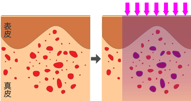 レーザーのパルス幅を長く設定した場合の図