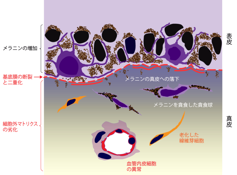 紫外線により光老化による真皮の変化