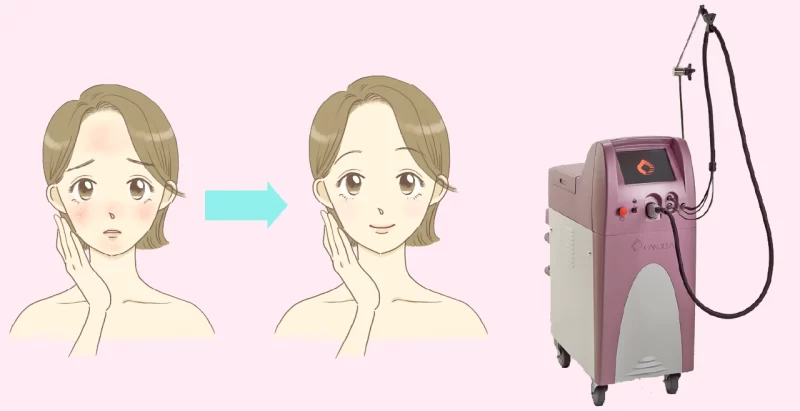 Vフェイシャルアイキャッチ画像