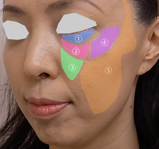 顔面の脂肪分画の図