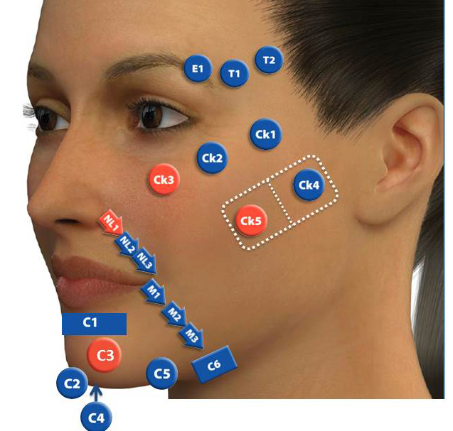 アラガンが推奨するMDコード