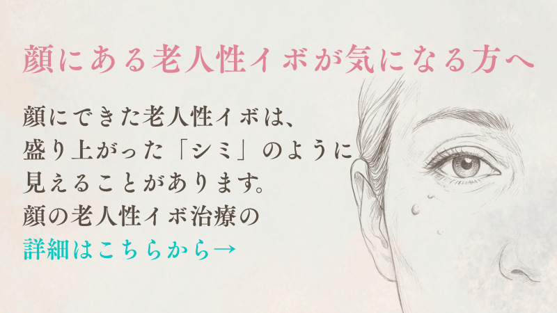 顔にある老人性イボが気になる方へ向けて、脂漏性角化症ページを案内するリンク画像